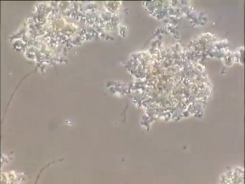 Observation d'un prélèvement de boue du pilote S5 (expérience de Kallel) : observation de la microfaune