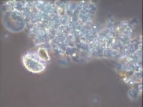 Examen d'une boue à fort grossissement : observation de la microfaune