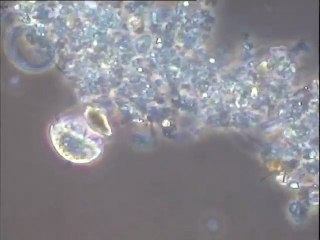 Examen d'une boue à fort grossissement : observation de la microfaune