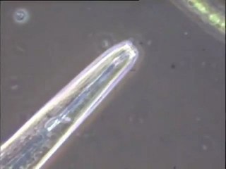 Détail de la microfaune d'un floc