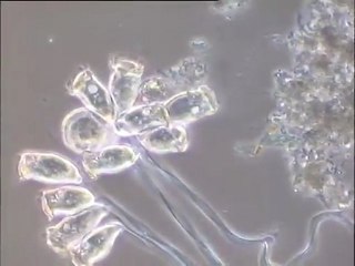 Mouvements de la microfaune d'un floc : rétraction puis expansion d'une colonie de vorticelles et déplacement d'un nématode sur le floc