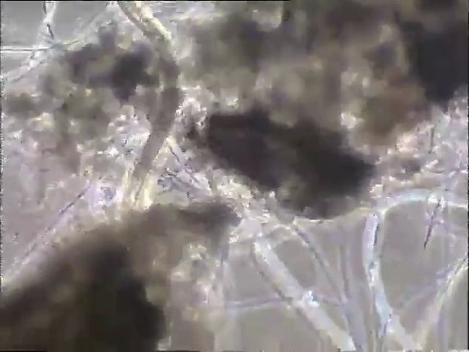 Examen à fort grossissement d'une boue âgée montrant des rotifères, des ciliés Spirotriches et des nématodes (bassins d'Orly)