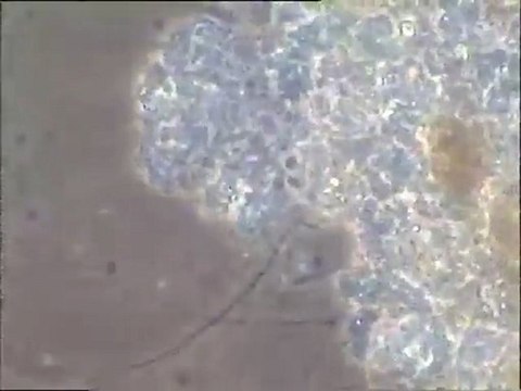 Examen d'une boue activée typique de Noisy, à Haliscomenobacter et à chaînettes