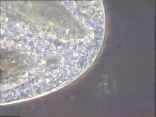 Prédation de rotifères par un Cilié Holotriche (Prorodon)