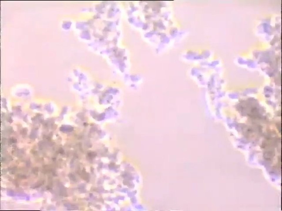 Examen d'une boue activée âgée à rotifères à plusieurs grossissements