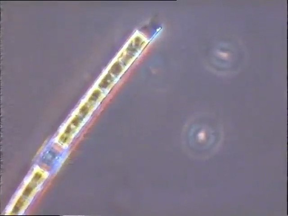 Examen de deux échantillons d'eau contenant des algues et comptage d'algues