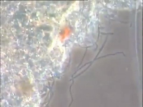 Détail des filaments et de la micro-faune d'une boue filamenteuse