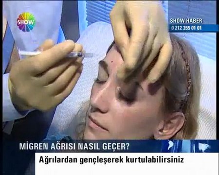 Op. Dr. Abdülkadir Göksel , Botox ile migren tedavisi