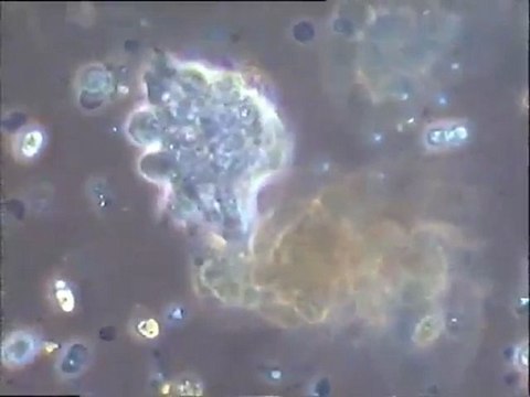 Examen de biomassses d'effluents vinicoles : échantillon témoin et boues traitées