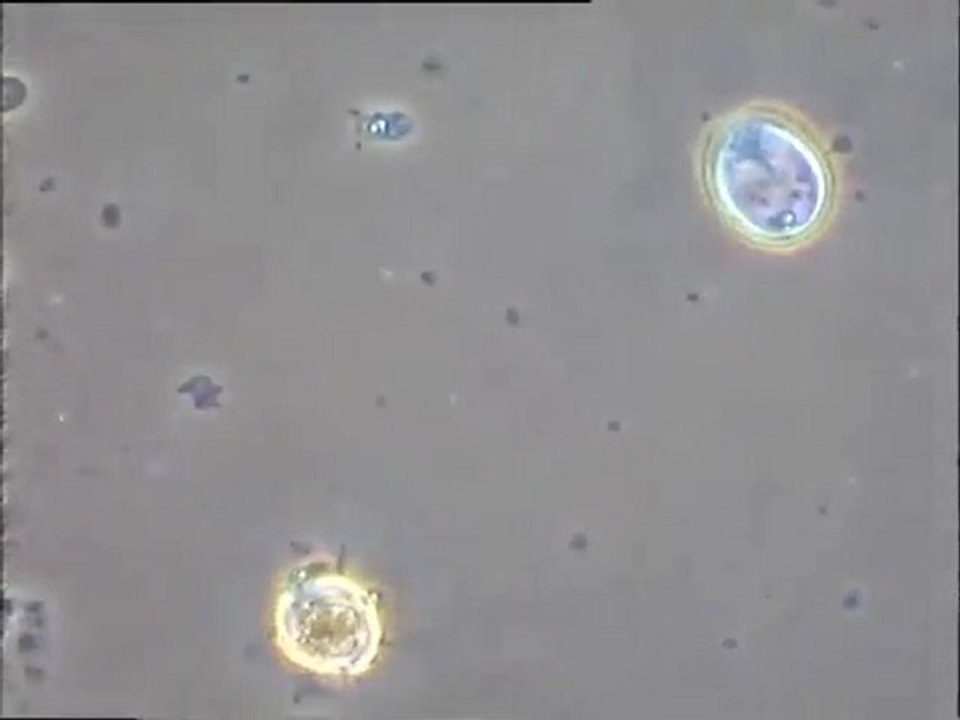 Examen de prélèvements faits dans des effluents vinicoles : boue native et exsudat liquide