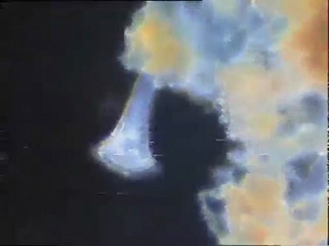 Examen de Stentors au microscope