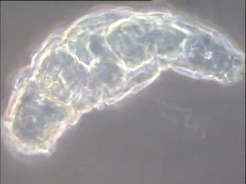 Microfaune d'une boue de Noisy-le-Grand, à très fort grossissement : examen des espèces