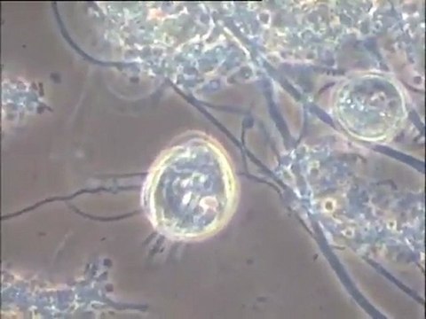 Détail de la microfaune et des filaments d'une boue filamenteuse de Noisy-le-Grand