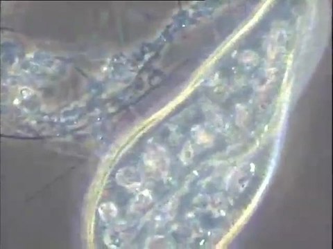 Boue activée : observation de deux ciliés en fort grossissement