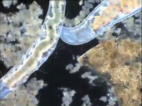 Vielle boue activée anaérobie : examen de micro-organismes remarquables