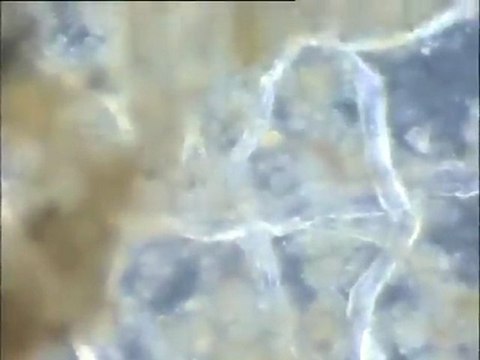 Examen des boues du Densadeg, dans l'état naturel puis diluées à l'eau distillée