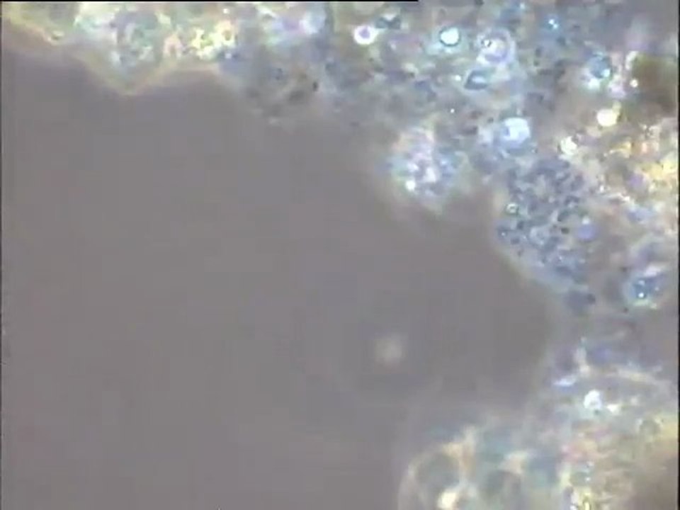 Examen des boues de lavage du Biofor de la station Seine centre