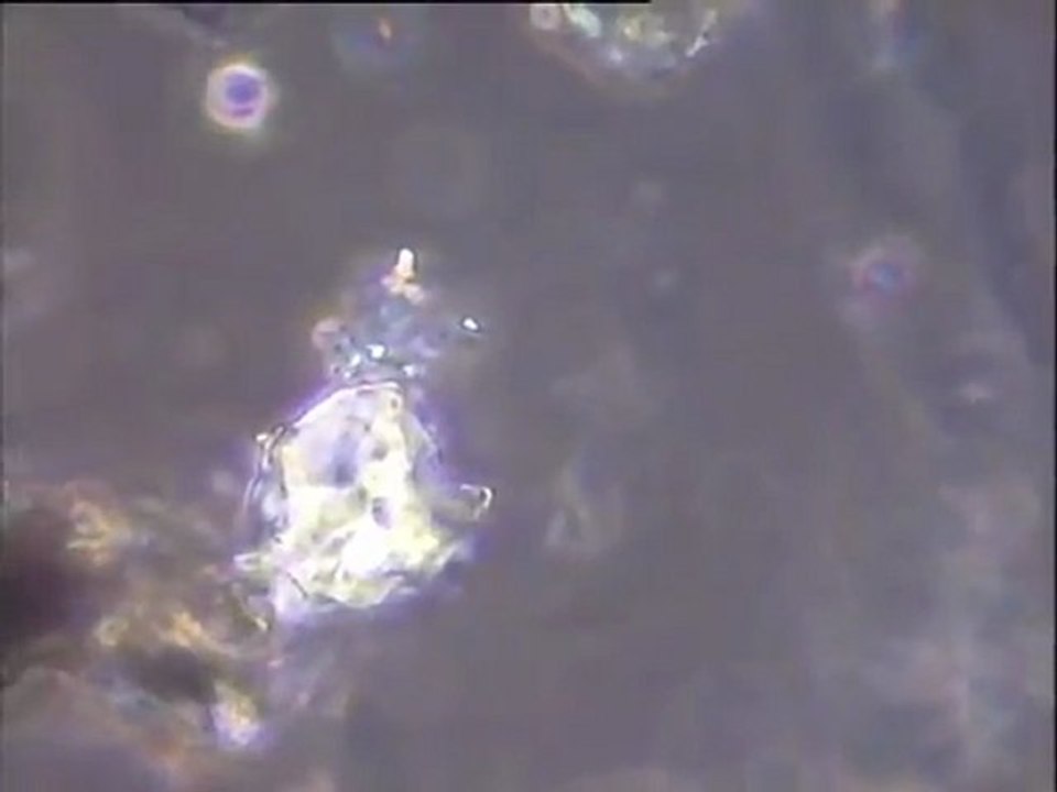 Examen des biomasses des biolites cassées du Biofor de la station Seine centre