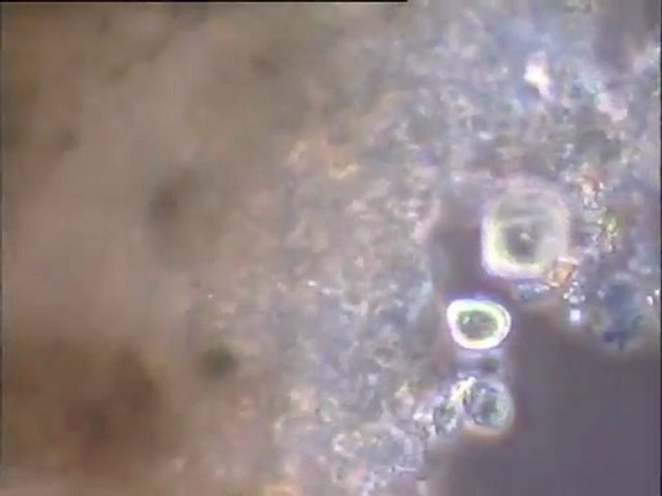 Examen des boues du Biostyr : biomasses décrochées de billes du Biostyr