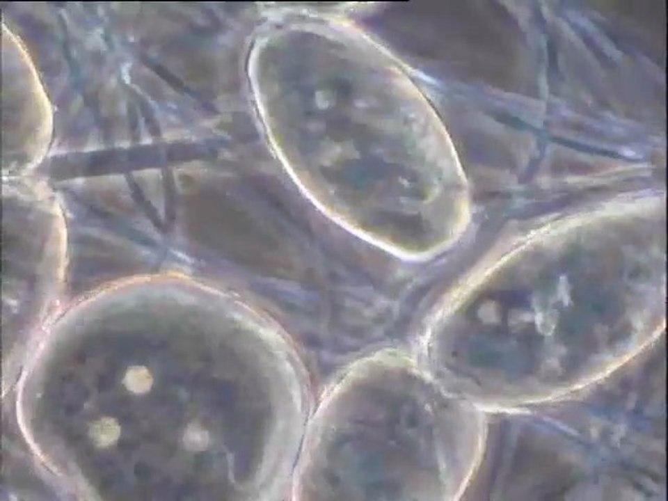 Examen des prélèvements faits à Achères IV sur deux emplacements avant l'expérience à l'eau oxygénée (pour éliminer les filaments)