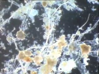 Etalonnage du Micromètre et examen des boues du Densadeg (plus petit maillage)