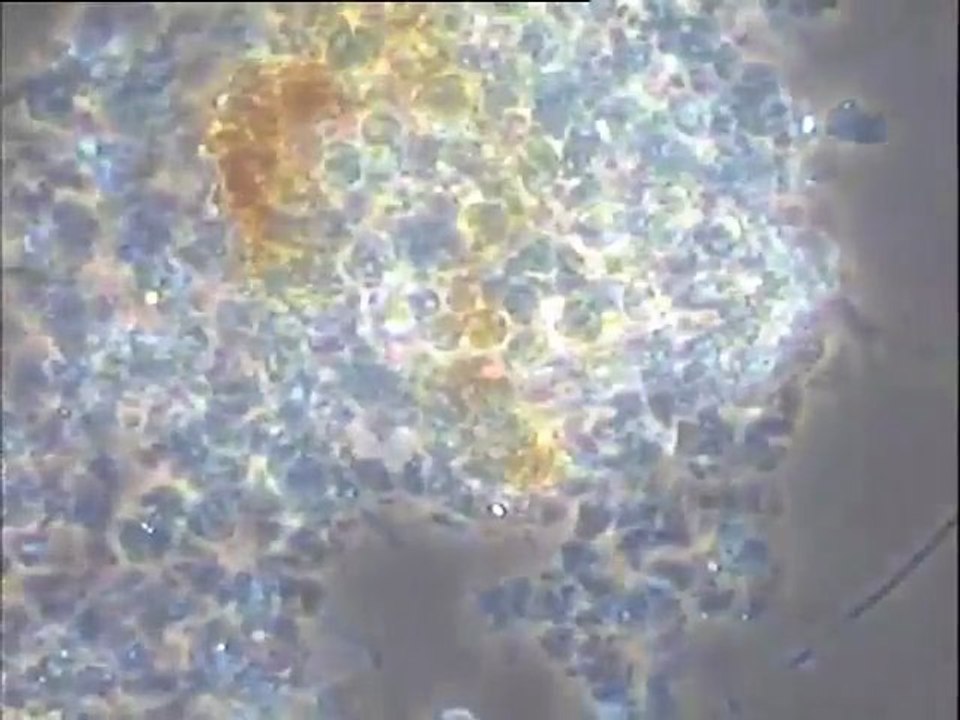 Examen d'une boue activée de Taïwan (usine pétrochimique) et de sa micro-faune
