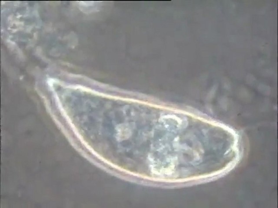 Examen des biomasses d'une boue de lavage du pilote de dénitrification Biostyr
