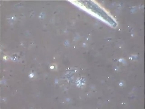 Examen des boues d'un bassin de traitement biologique d'effluents de tannerie