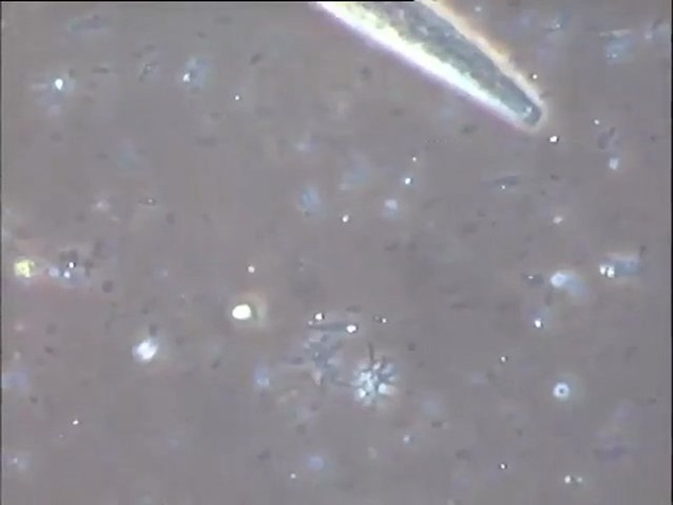 Examen des boues d'un bassin de traitement biologique d'effluents de tannerie