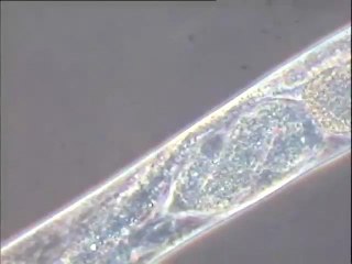 Bassin de traitement biologique de tannerie : observation d'un nématode