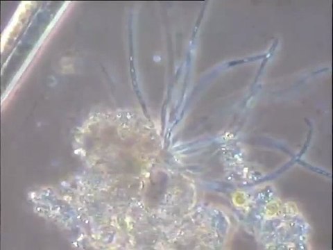 Examen d'une boue décantée de bassin de traitement biologique de tannerie (boue fraîche)