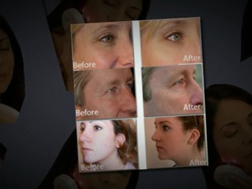 Acne Treating Blue Light Therapy