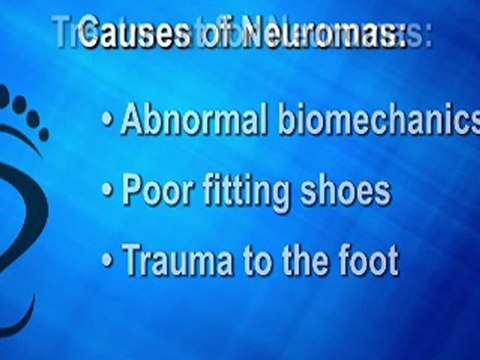 Morton’s Neuroma - Podiatrist in Bethesda, MD and Springfield, VA