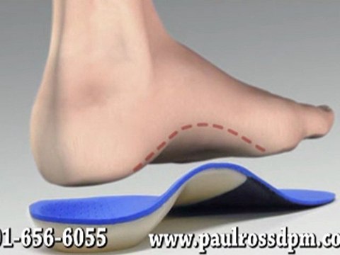 Custom Orthotics - Podiatrist in Bethesda, MD and Springfield, VA