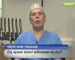Dr.Nihat Tanfer - Diş apsesi tedavi edilmezse ne olur-