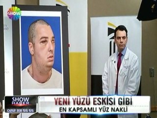 Amerika'da yüz nakli - 28 mart 2012
