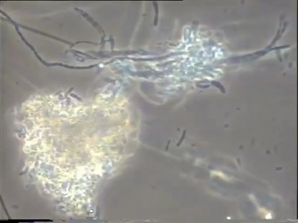 Examen de la boue activée du bassin B d’Achères : observation des biomasses au démarrage du traitement au Nutriox