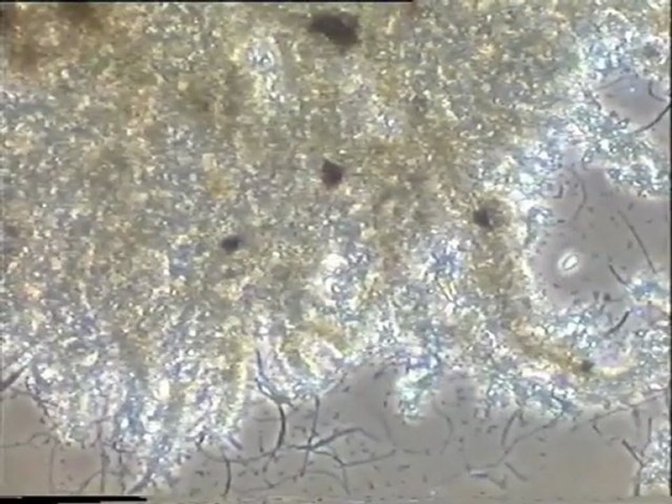 Examen d’une préparation de boue activée de la file A d’Achères, après un jour de traitement au Nutriox : observation en fond noir et en contraste de la densité et de la morphologie des flocs et des filaments
