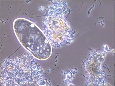 Examen au microscope des biomasses d’une boue de lavage fraîche du Biostyr : observation au microscope à fort grossissement des microorganismes présents