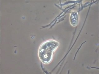Prédation d'un cilié sur un flagellé : deuxième maillon de la chaine alimentaire au niveau microscopique dans les biomasses épuratrices