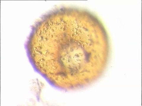 Examen des biomasses du sessile de Noisy-le-Grand