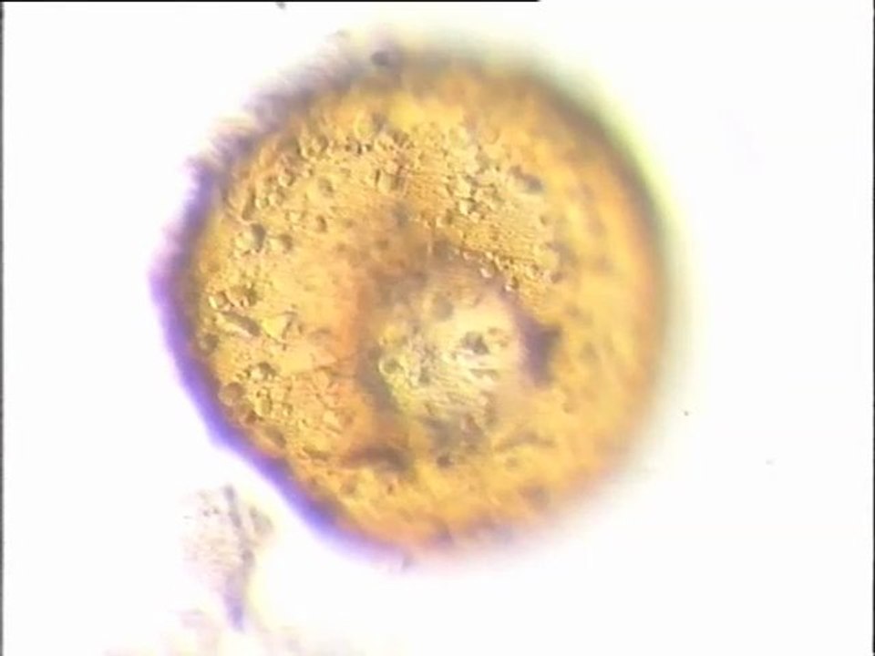 Examen des biomasses du sessile de Noisy-le-Grand