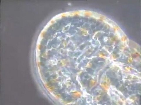 Détail des biomasses du sessile de Noisy-le-Grand : organismes rencontrés