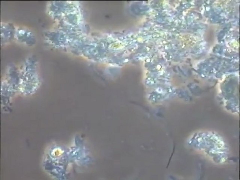 Examen des boues activées de la ville de Toulouse : station de Blagnac. Boues à forte charge (1er bassin)