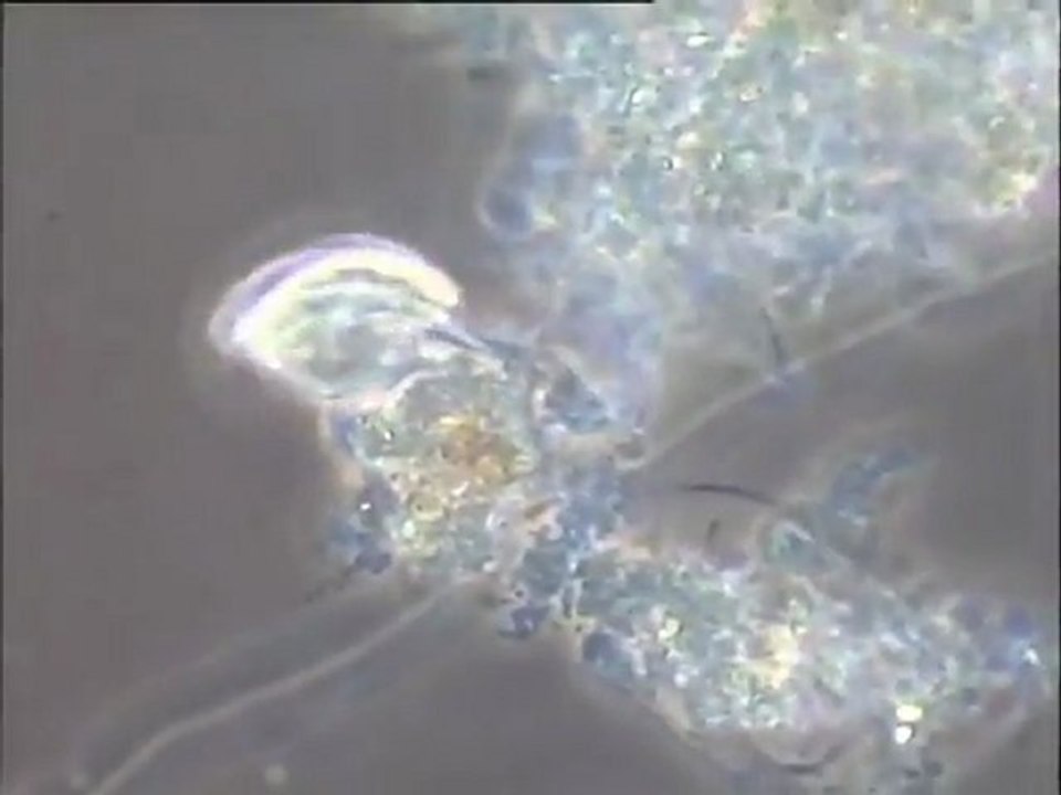 Examen des boues activées de la ville de Toulouse (station de Blagnac) : boues à moyenne charge (2nd bassin), de bonne qualité