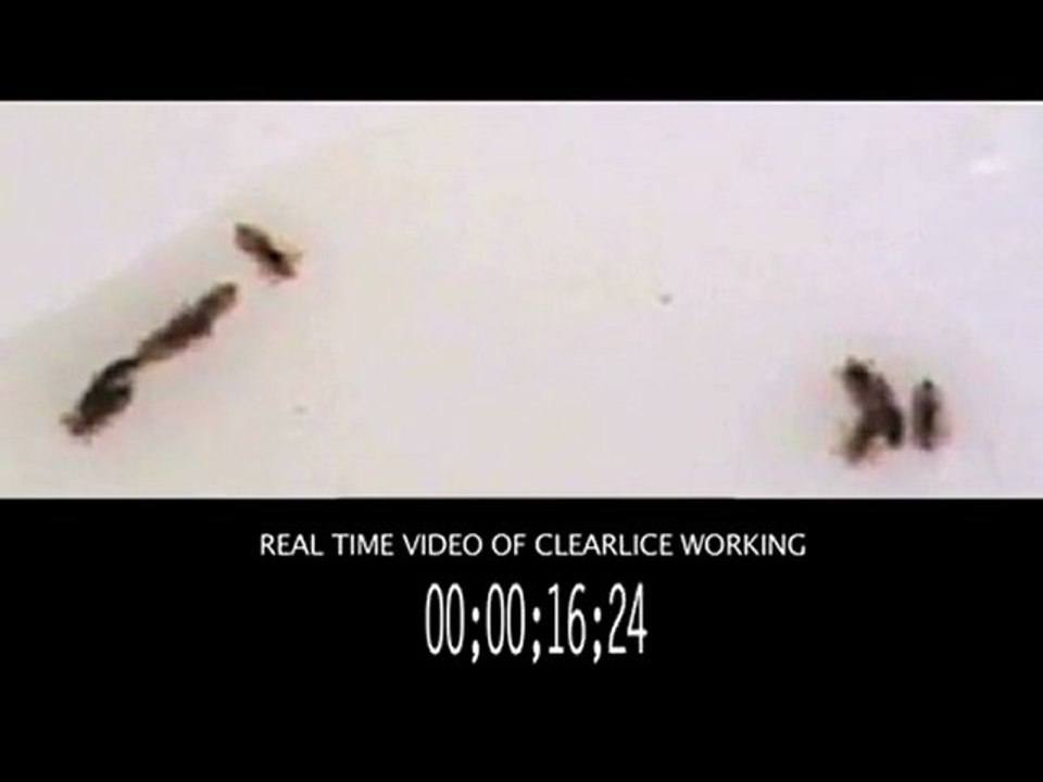 ClearLice Reviews - Does ClearLice Shampoo Really Work?