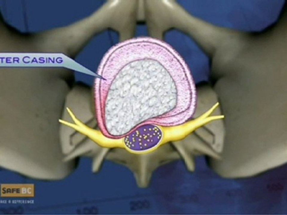Bedensel yük kaldırmalarda iş güvenliği 1 www.kumanda.org