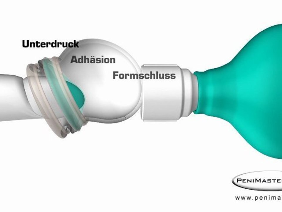 Animation Funktionsweise PeniMasterPRO