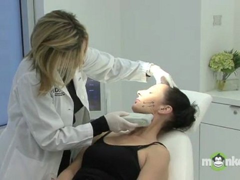 Skin Tightening Procedures