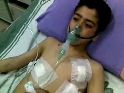 فري برس حلب إعزاز طفل مصاب جراء القصف 30 3 2012